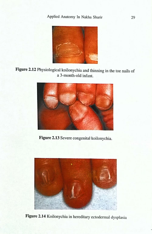Applied Anatomy In Nakha Sharira